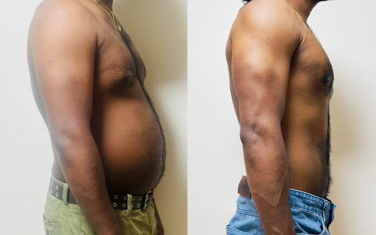 Lakshitha before and after — 20 kg lost over 5 months of online coaching